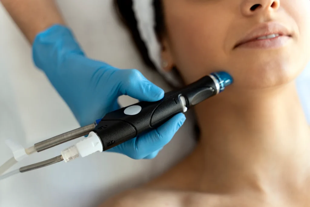 dermapen