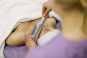 sesion-dermapen